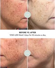 Load image into Gallery viewer, VISO - FDA Certified Red Light Therapy Mask