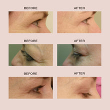 Load image into Gallery viewer, Alya | Anti-Aging Red LED Eye Glasses | VANITY PLANET