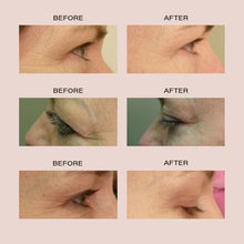 Load image into Gallery viewer, Alya | Anti-Aging Red LED Eye Glasses | VANITY PLANET