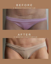 Load image into Gallery viewer, Restorative Scar Treatment | Nēmah - Pothos Beauty