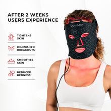 Load image into Gallery viewer, VISO - FDA Certified Red Light Therapy Mask
