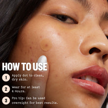Load image into Gallery viewer, Acne Treatment Dots
