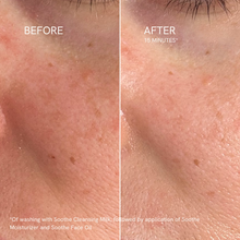 Load image into Gallery viewer, Soothe SuperFlower Firming Face Oil
