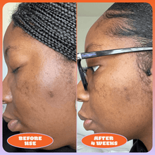 Load image into Gallery viewer, Milky Fade Serum | Blume - Pothos Beauty
